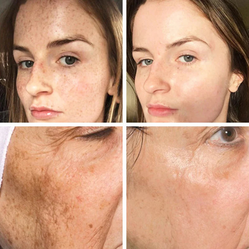 Luxios AXIS-Y Korean Dark Spot Correcting Serum