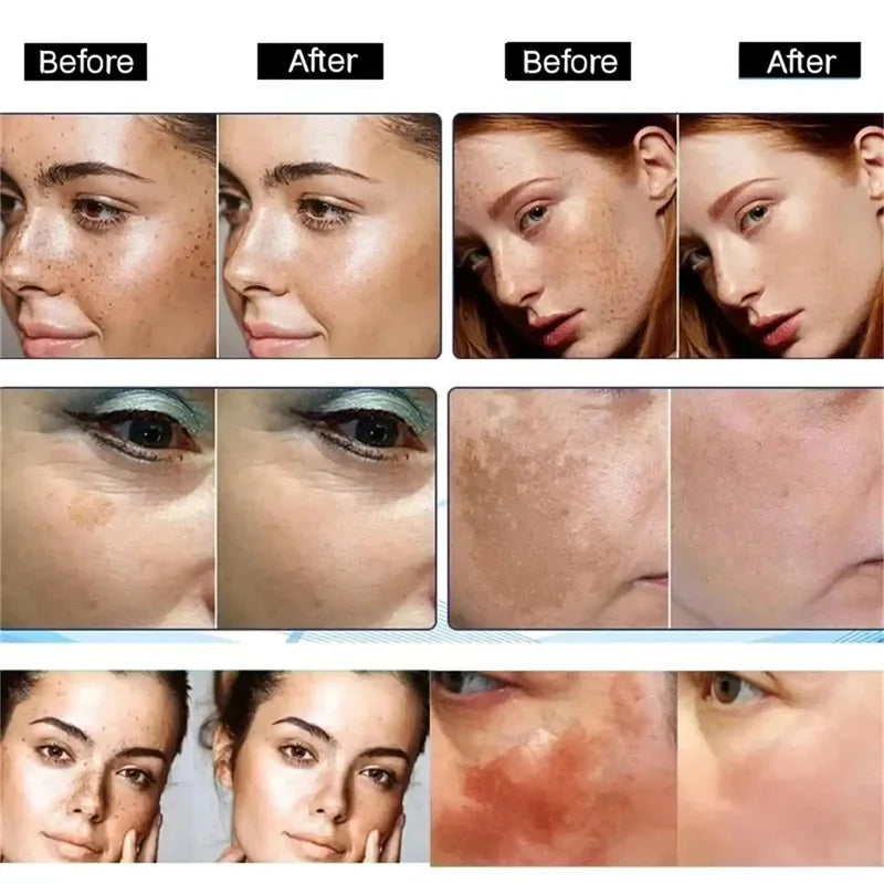Luxios AXIS-Y Korean Dark Spot Correcting Serum