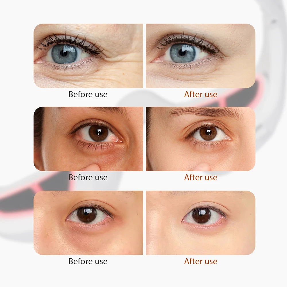 Luxios Pro™ Red Light Therapy Eye Mask
