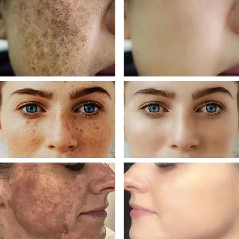 Luxios AXIS-Y Korean Dark Spot Correcting Serum