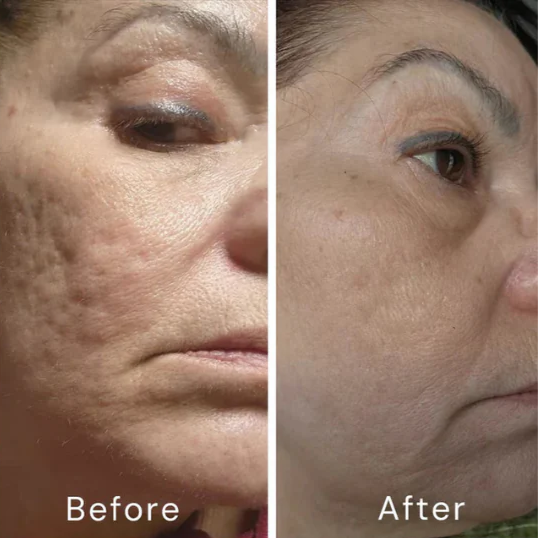 Luxios Face Revival Cream