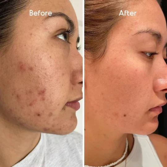 Luxios Face Revival Cream