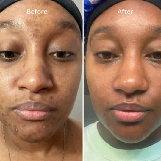 Luxios Face Revival Cream