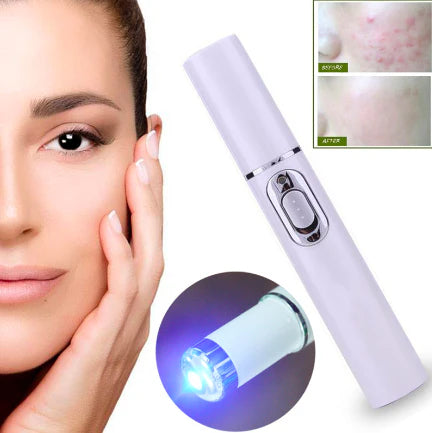 Luxios Pro™ Blue Light Therapy Pen